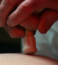 Massage/Triggerpunktbehandlung
